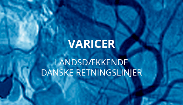 vacier-kar